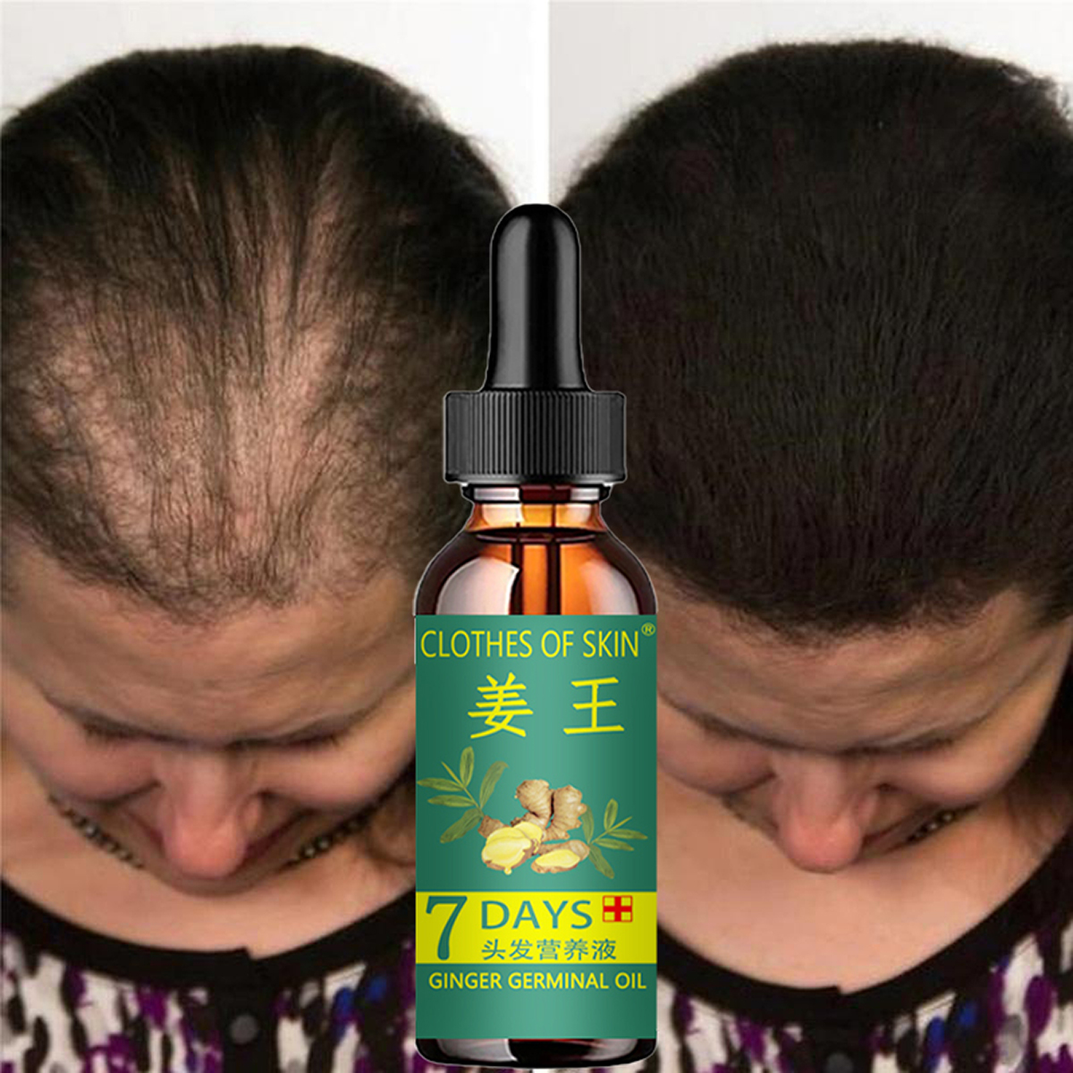 Hair Care Essential Oil Atomizing - Hair Growth Products Ginger Essence Fast