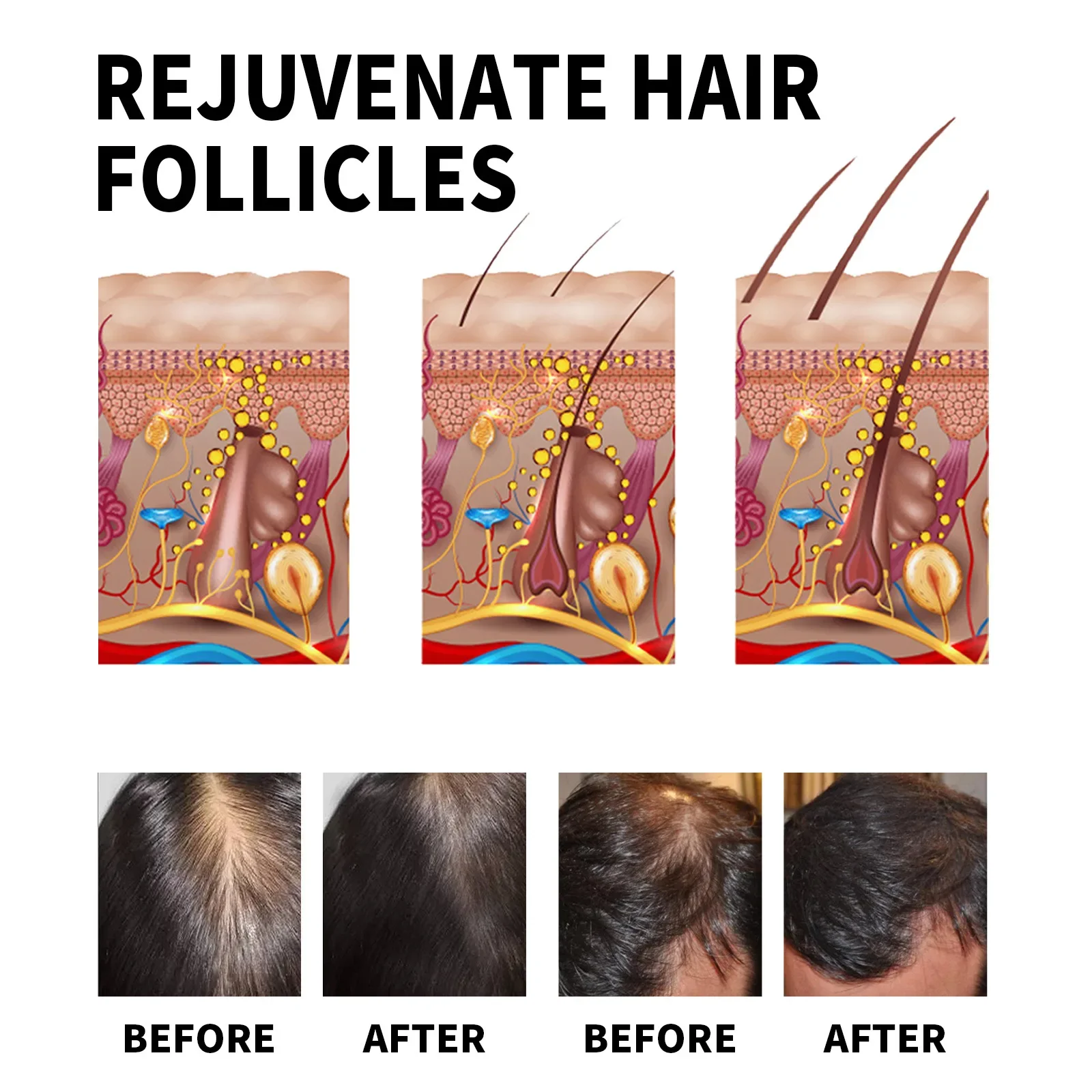 Ginger Hair Growth Products Fa - Hair Care Essential Oil Atomizing recension och pris