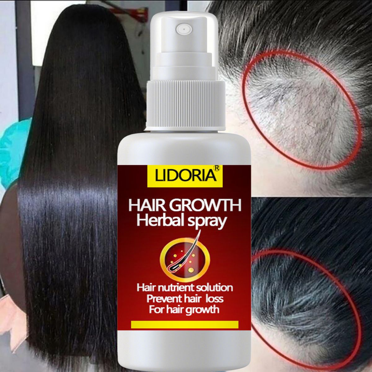 Hair Fast Growth and Hair Care - Hair Care Essential Oil Atomizing recension och pris