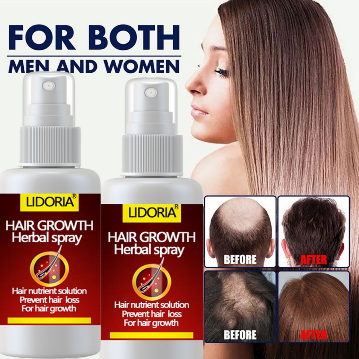 Hair Fast Growth and Hair Care - Hair Care Essential Oil Atomizing recension och pris