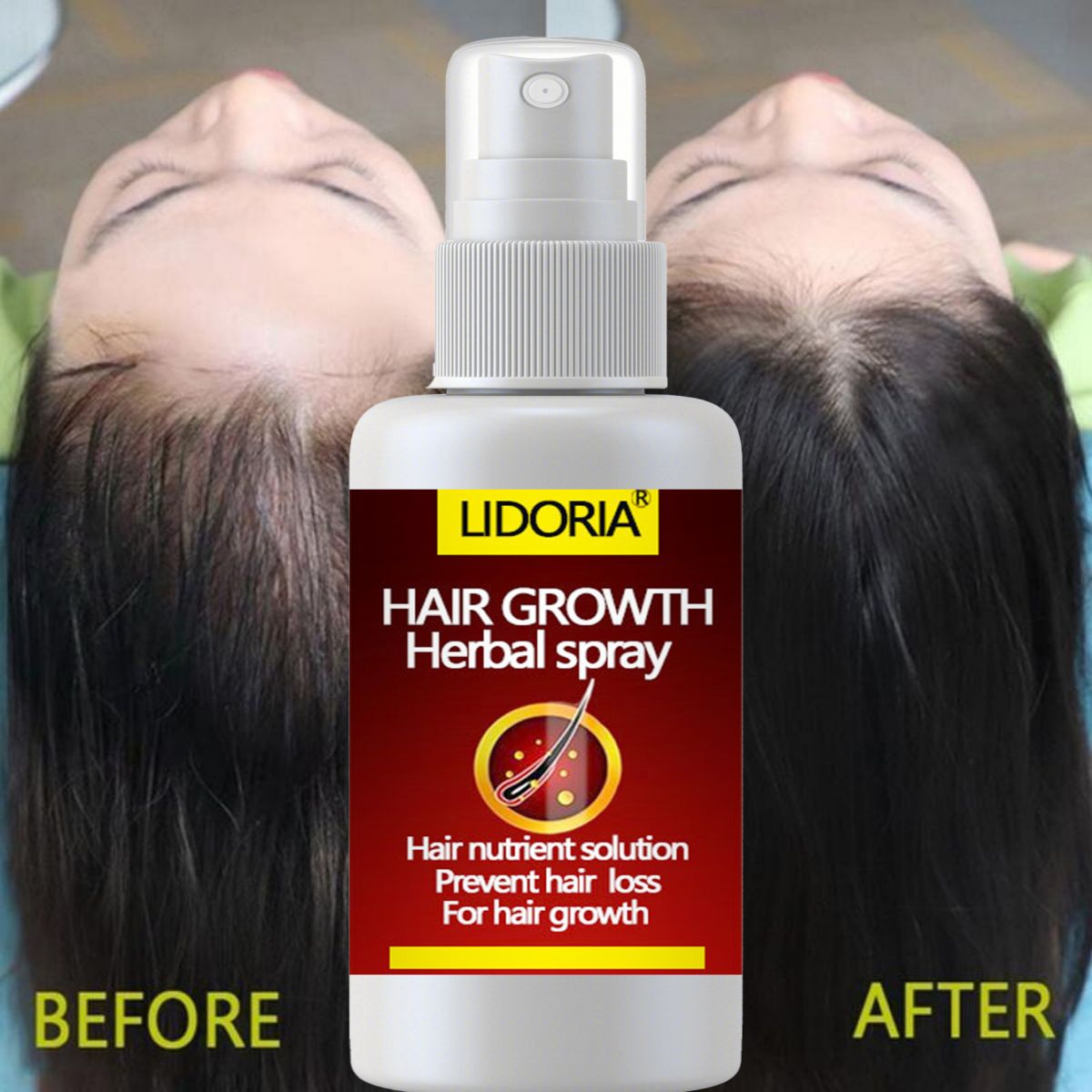 Hair Fast Growth and Hair Care - Hair Care Essential Oil Atomizing recension och pris