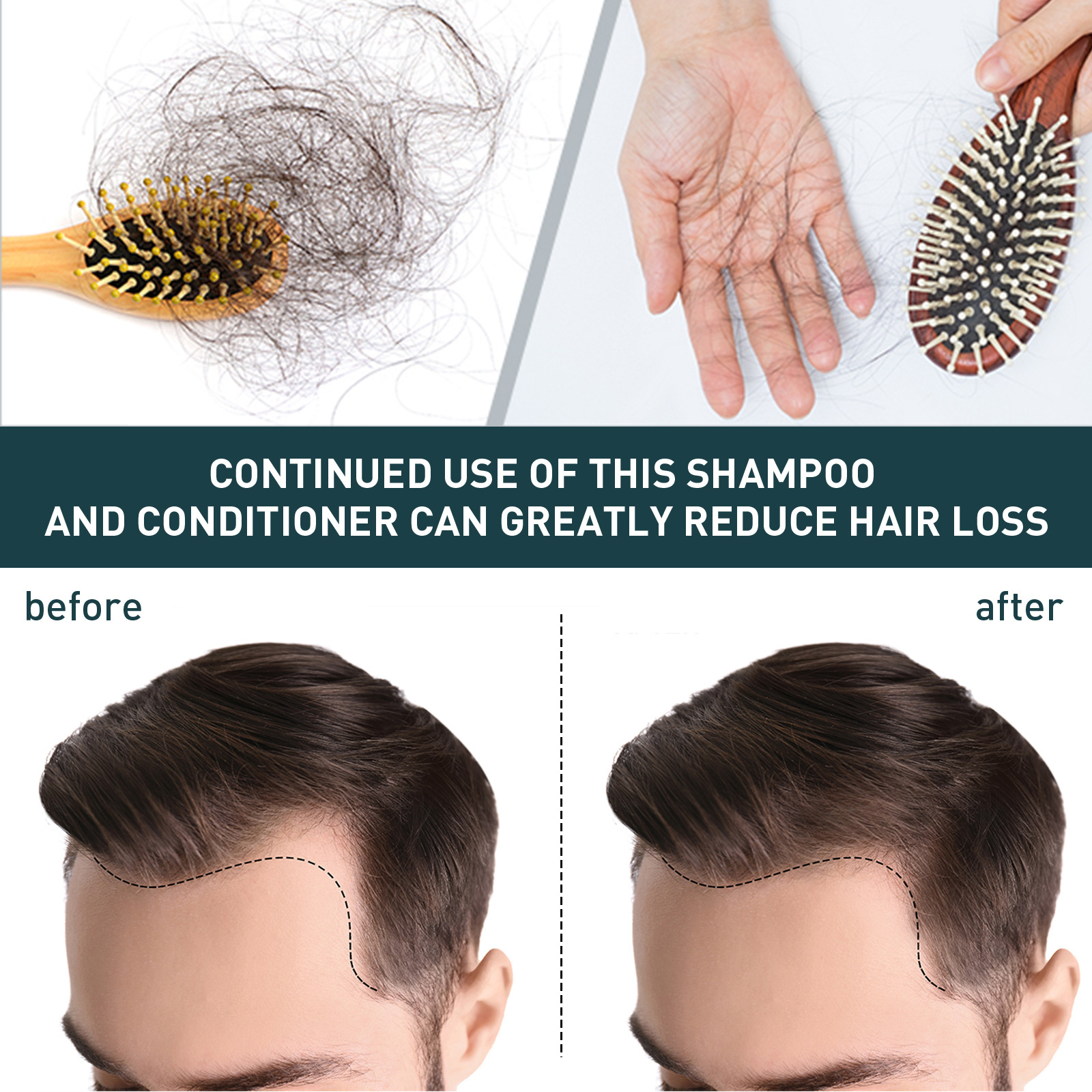 2pcsx100ml Hair Growth Shampoo - Hair Care Natural Ingredients recension och pris