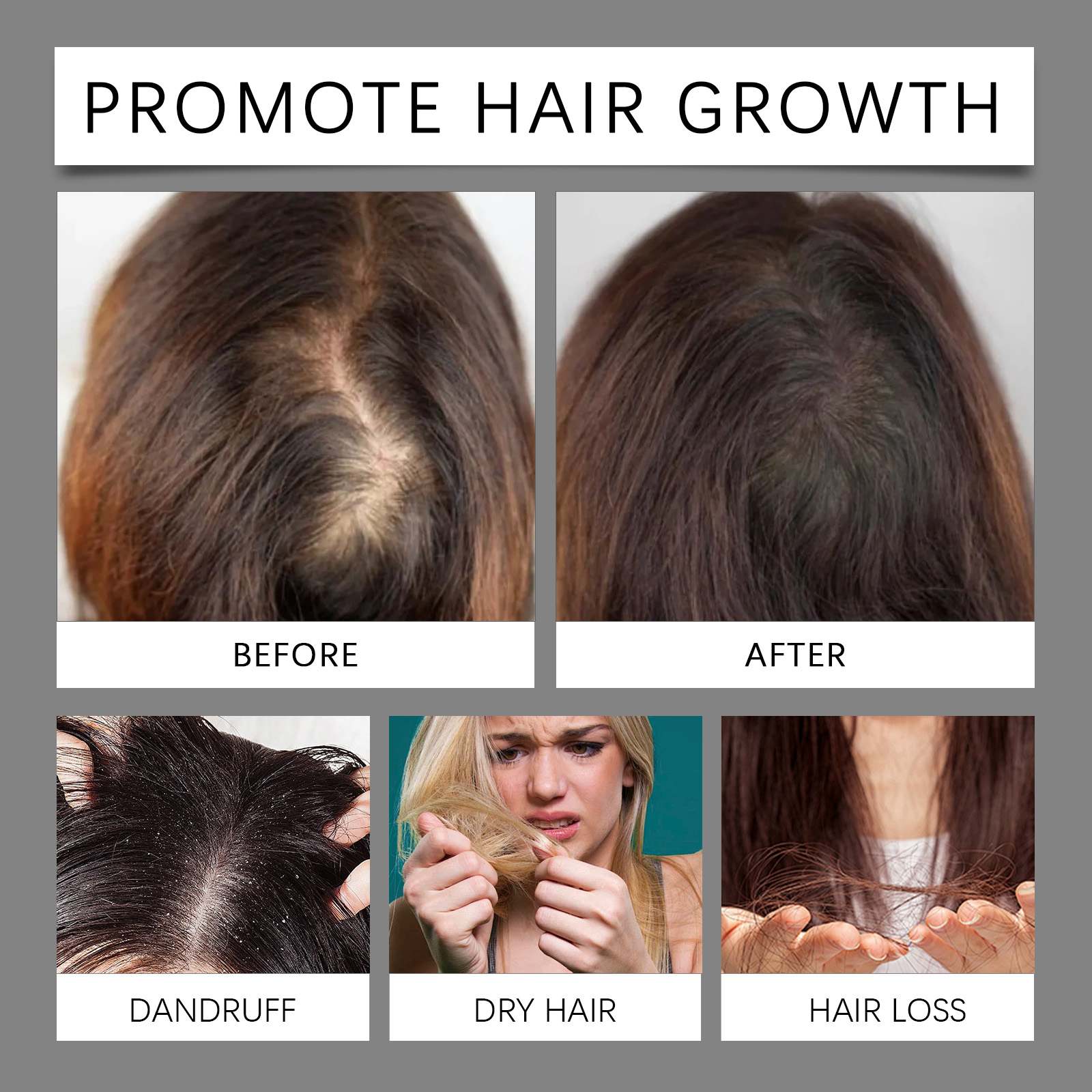 30ml Hair Care Essential Oil T - Hair Growth Serum Oil recension och pris