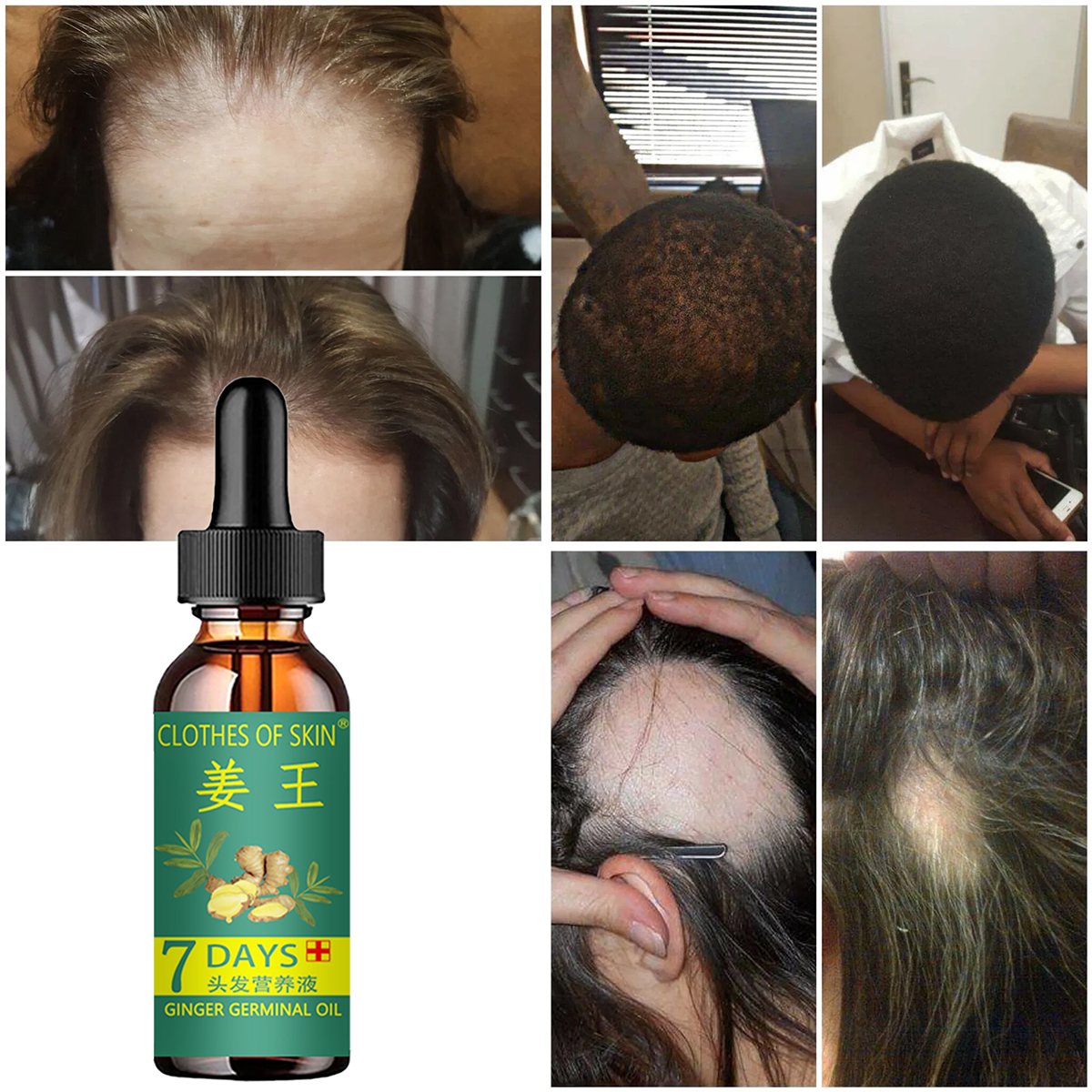 Hair Growth Products Ginger Es - Hair Care Essential Oil Atomizing recension och pris