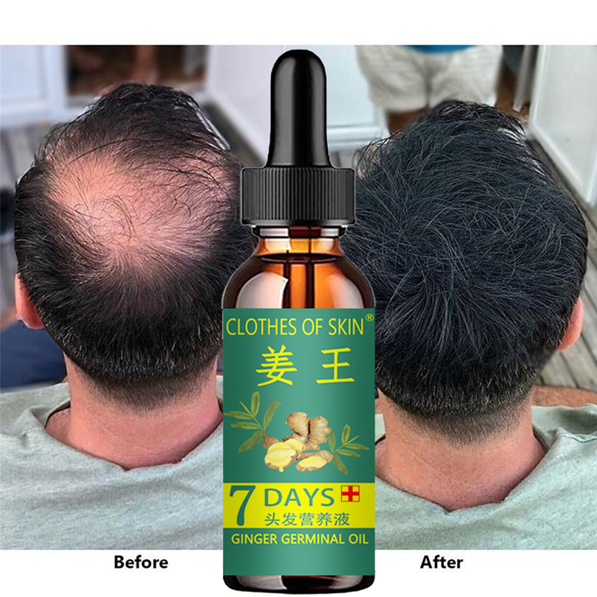 Hair Growth Products Ginger Es - Hair Care Essential Oil Atomizing recension och pris