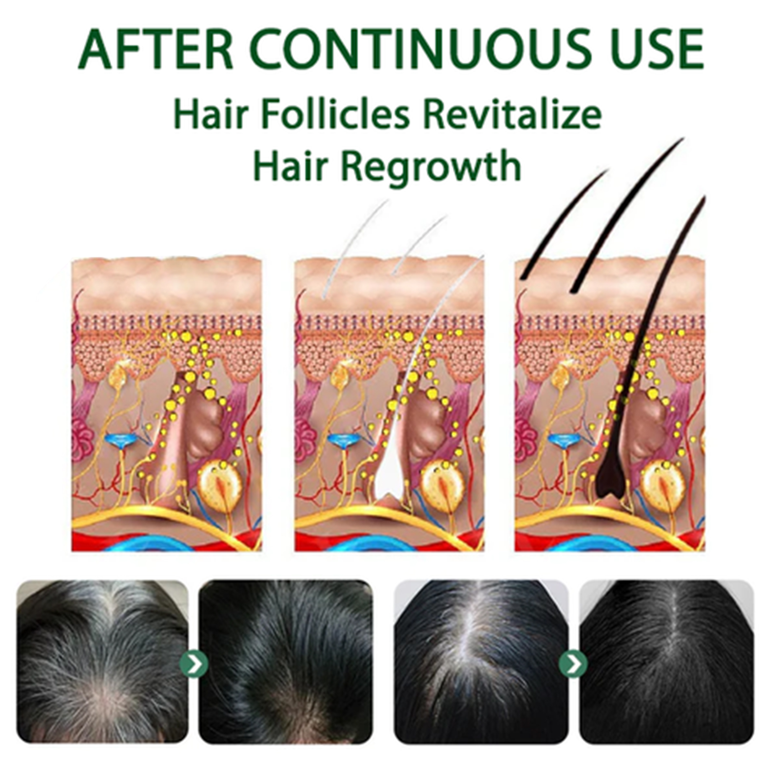 Eelhoe Black Hair Spray Promot - Hair Care Natural Ingredients recension och pris