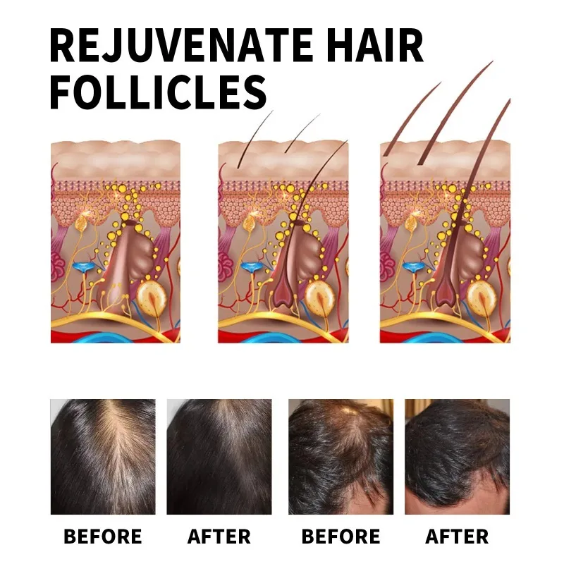 Hair Growth Serum Fast Growing - Hair Care Essential Oil Atomizing recension och pris