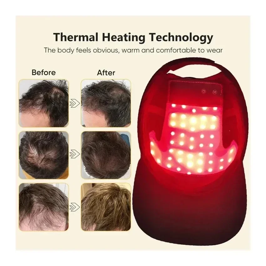 NEW LED Red Blue Light Therapy - Hair Care Vegan recension och pris
