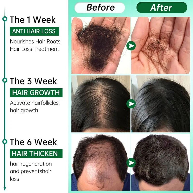 7 Days Fast Grow Hair Growth S - Hair Care Essential Oil Atomizing recension och pris