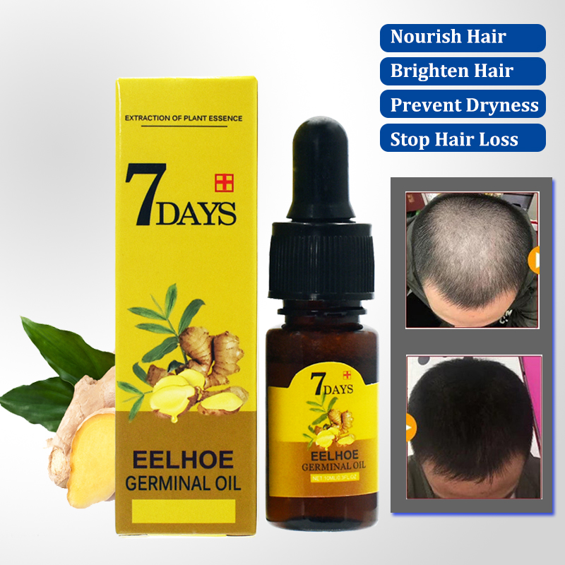 Ginger Hair Growth Essential O - Hair Care Essential Oil Atomizing recension och pris