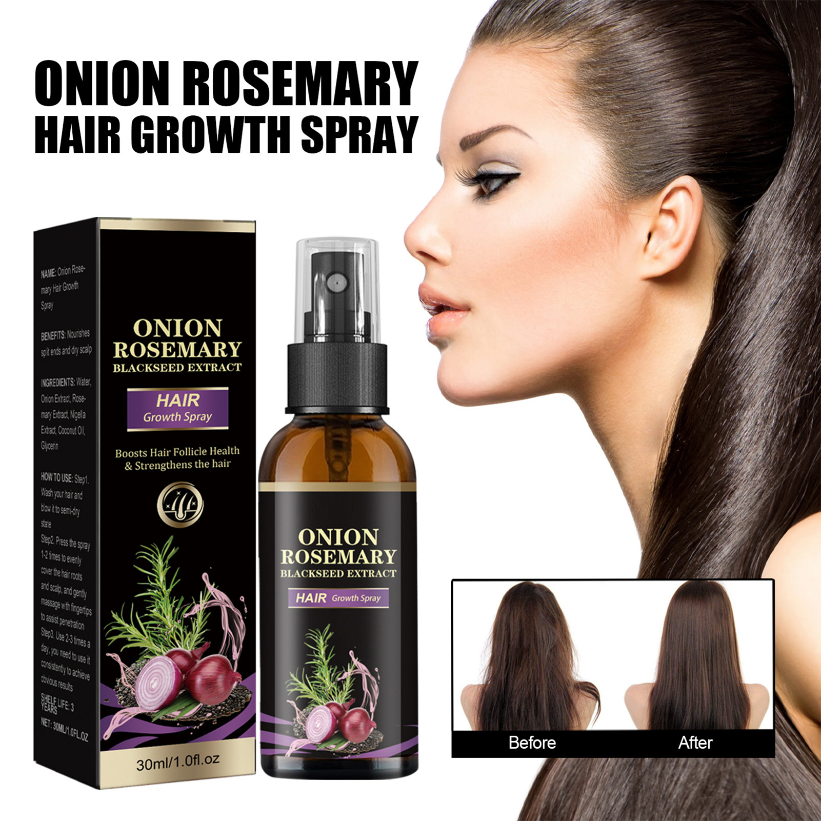 30ml Hair Growth Spray Onion R - Hair Growth Serum Oil recension och pris