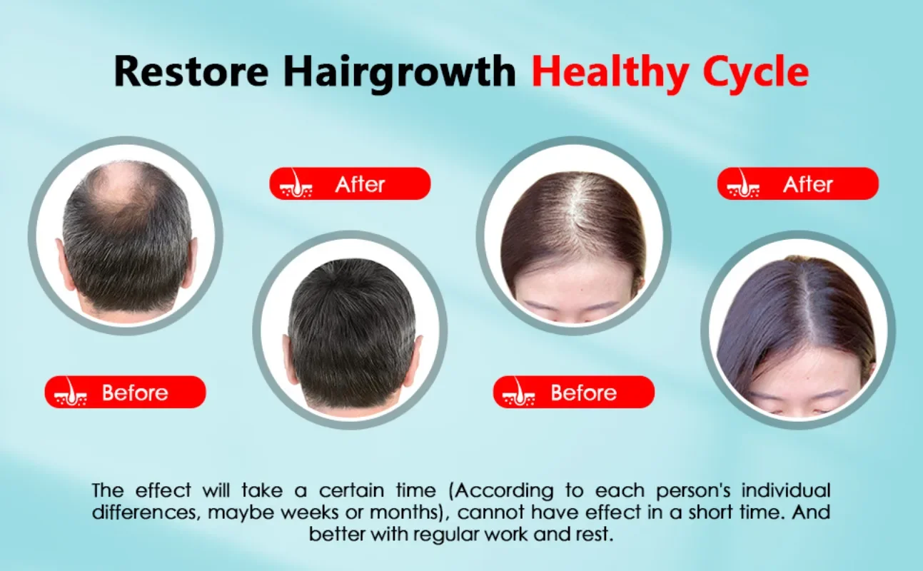 Hair Growth Cap Rechargeable 2 - Hair Care Vegan recension och pris