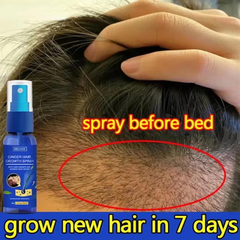 Ginger Hair Growth spray Anti  - Hair Growth Serum Oil recension och pris