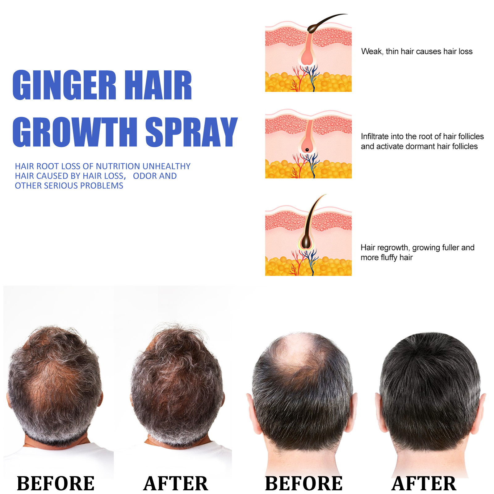 Ginger Hair Growth spray Anti  - Hair Growth Serum Oil recension och pris