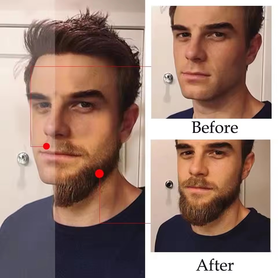 High Quality Fast Beard Growth - Hair Care Essential Oil Atomizing recension och pris